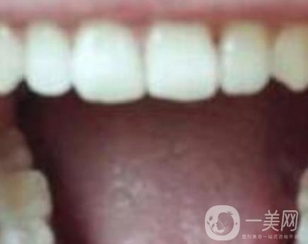 張家港澳洋醫(yī)院整牙