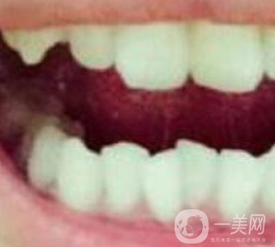 張家港澳洋醫(yī)院整牙