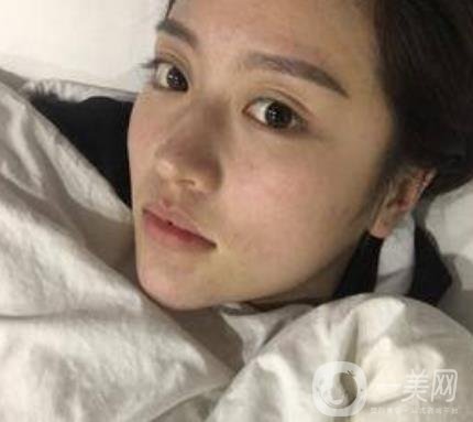 河北省人民醫(yī)院整形外科價格表新版來襲，附去下頜骨案例