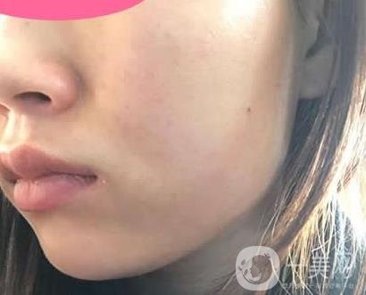 寧波第一醫(yī)院整形科價(jià)格表收費(fèi)明細(xì)上線，看打玻尿酸真人案例