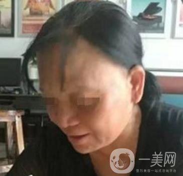 廣東省人民醫(yī)院整形科價格表，附祛斑整形日記