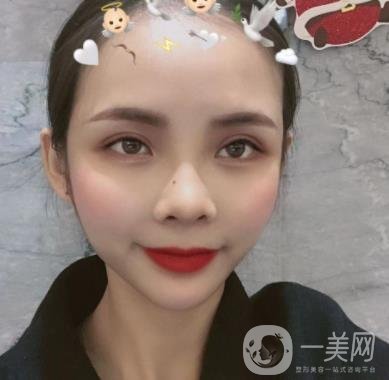 西安交通大學(xué)附屬醫(yī)院整形美容科價(jià)格表和雙眼皮案例一覽