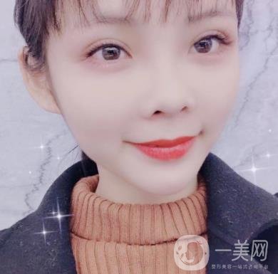 西安交通大學(xué)附屬醫(yī)院整形美容科價(jià)格表和雙眼皮案例一覽