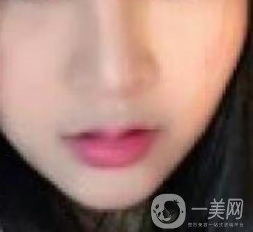 蘭山區(qū)人民醫(yī)院整牙