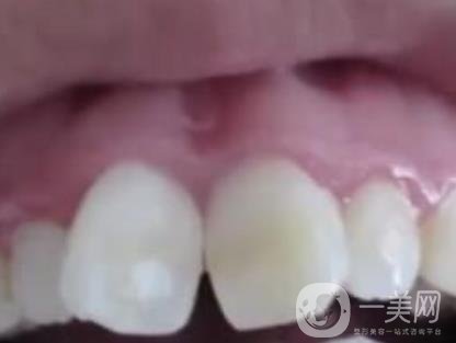 泉州人民醫(yī)院整牙