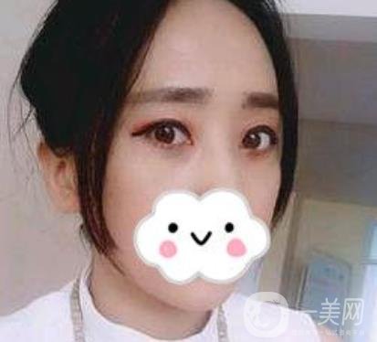 第九人民醫(yī)院去眼袋