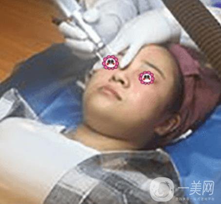 岳陽(yáng)市第一人民醫(yī)院整形美容科祛斑好嗎？?jī)r(jià)格表和案例日記分享