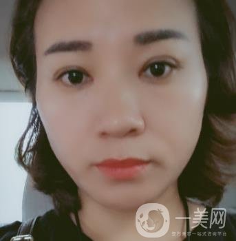 中山一院整形科價(jià)格表,及切腋臭日記一覽