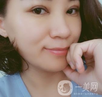 中山一院整形科價(jià)格表,及切腋臭日記一覽