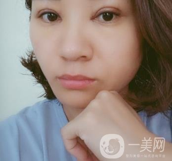 中山一院整形科價(jià)格表,及切腋臭日記一覽