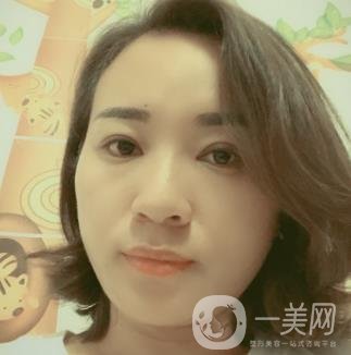 中山一院整形科價(jià)格表,及切腋臭日記一覽