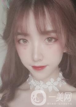 南昌二附院整形科價(jià)格表2020，附肋軟骨隆鼻整形案例