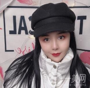 景德鎮(zhèn)第一人民醫(yī)院整形科價格表，附面部吸脂瘦臉案例