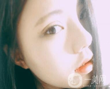 西安唐都醫(yī)院價(jià)格表價(jià)目表，內(nèi)附吳瓊隆鼻整形日記