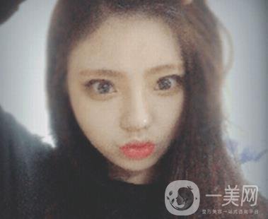 西安唐都醫(yī)院價(jià)格表價(jià)目表，內(nèi)附吳瓊隆鼻整形日記