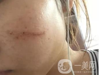 西安市中心醫(yī)院整形科價(jià)目?jī)r(jià)格一覽，附陶諫祛疤案例*果圖