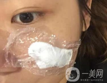 西安市中心醫(yī)院整形科價(jià)目?jī)r(jià)格一覽，附陶諫祛疤案例*果圖