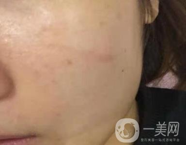 西安市中心醫(yī)院整形科價(jià)目?jī)r(jià)格一覽，附陶諫祛疤案例*果圖