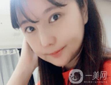 廣州博仕整形醫(yī)院做鼻子多少錢?價格表和整形恢復(fù)日記一覽