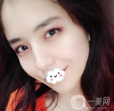 上海伯思立整形怎么樣？附沈國雄隆鼻案例及整形價(jià)格表