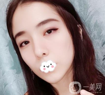 上海伯思立整形怎么樣？附沈國雄隆鼻案例及整形價(jià)格表