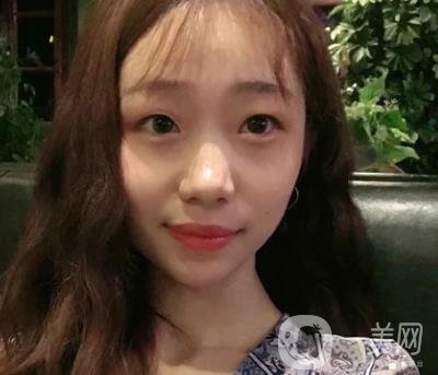 上海華美李志海磨骨多少錢(qián)？案例有嗎？整形價(jià)格表一覽