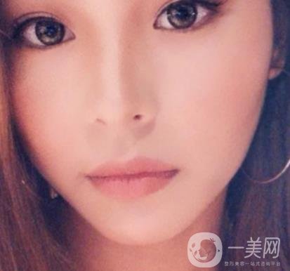 上海九院切下頜角手術(shù)經(jīng)歷分享，附2020整形價格一覽表