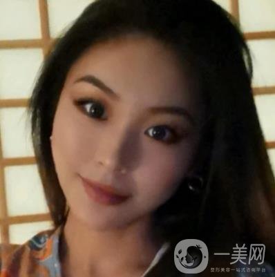 上海九院切下頜角手術(shù)經(jīng)歷分享，附2020整形價格一覽表