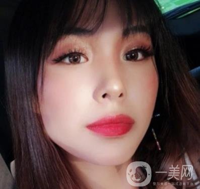 上海九院切下頜角手術(shù)經(jīng)歷分享，附2020整形價格一覽表