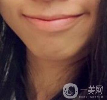 長(zhǎng)征醫(yī)院 整牙