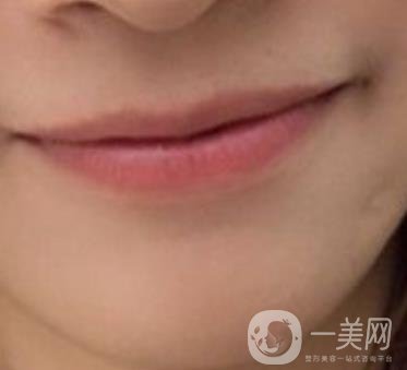 長(zhǎng)征醫(yī)院 整牙