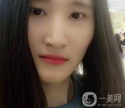 北京市海淀醫(yī)院整牙多少錢？看價格表及案例*果