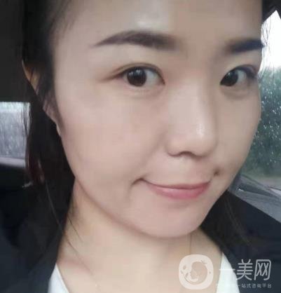 吉大一院整形美容科價格表費用明細，附祛斑案例