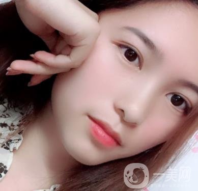 沈陽軍區(qū)總醫(yī)院整形外科價(jià)格表2020，附雙眼皮案例