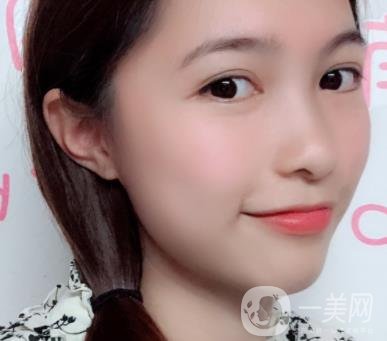 沈陽軍區(qū)總醫(yī)院整形外科價(jià)格表2020，附雙眼皮案例