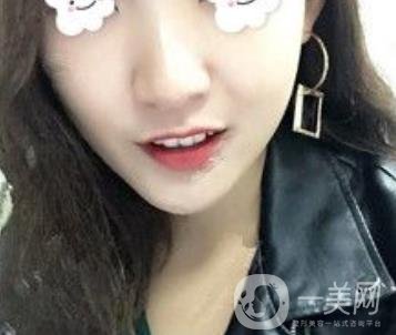 浙二醫(yī)院整形美容科價格表*新版，附激光祛斑*終*果圖