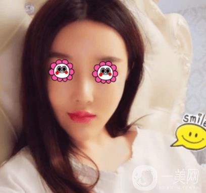 長沙中南大學(xué)*三醫(yī)院整形美容外科隆鼻多少錢？價(jià)格表及案例詳情