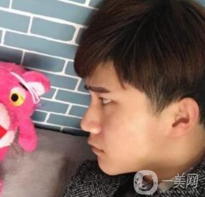 棗莊市立醫(yī)院燒傷整形美容科做光子嫩膚好嗎？價(jià)格表及術(shù)后*果分享