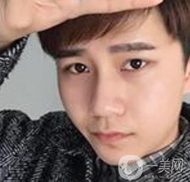 棗莊市立醫(yī)院燒傷整形美容科做光子嫩膚好嗎？價(jià)格表及術(shù)后*果分享