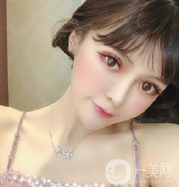 石家莊市醫(yī)院整形美容外科價格表2020，附雙眼皮實例