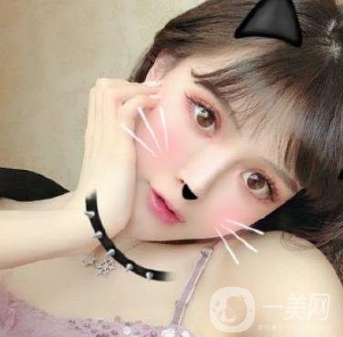 石家莊市醫(yī)院整形美容外科價格表2020，附雙眼皮實例