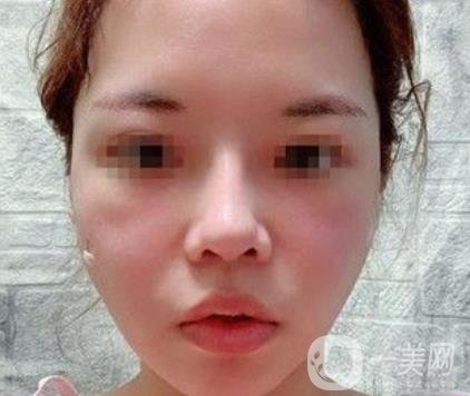 四川省人民醫(yī)院整形外科游曉波磨骨怎么樣?價格收費明細(xì)表一覽