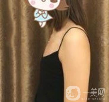 上海李斌醫(yī)療美容隆胸怎么樣?項目整形價格表收費標準公布