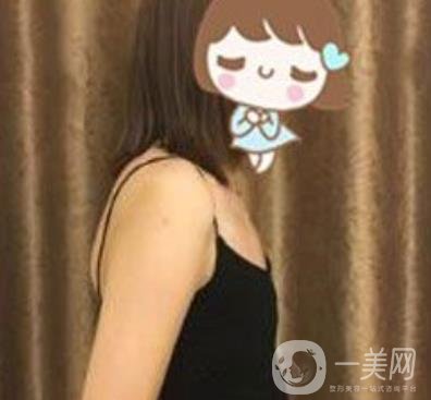 上海李斌醫(yī)療美容隆胸怎么樣?項目整形價格表收費標準公布