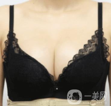 上海美貝爾明橋醫(yī)院價格(目)一覽表，附孫超醫(yī)生隆胸經(jīng)驗(yàn)分享