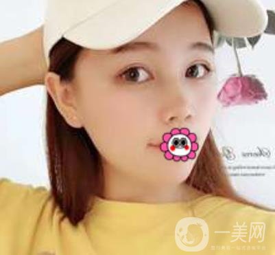 河南省人民醫(yī)院誰做雙眼皮好？附案例及2020整形價格表