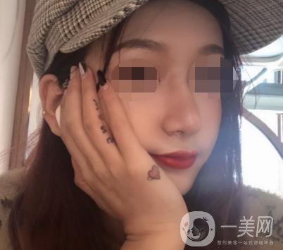 遼寧省人民醫(yī)院美容科怎么樣？附袁繼龍隆鼻案例