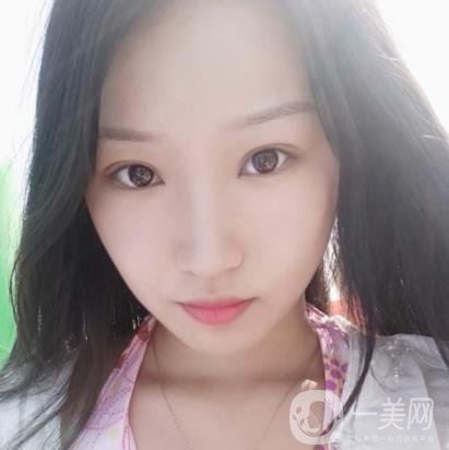 北大醫(yī)院美容價(jià)格表，附自體脂肪填充面部前后照