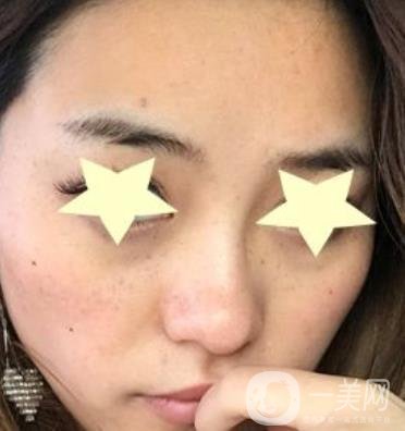 珠海中西醫(yī)結(jié)合醫(yī)院整形價(jià)格表及激光祛斑案例一覽