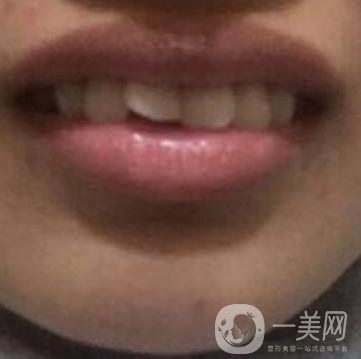 北京醫(yī)院整牙